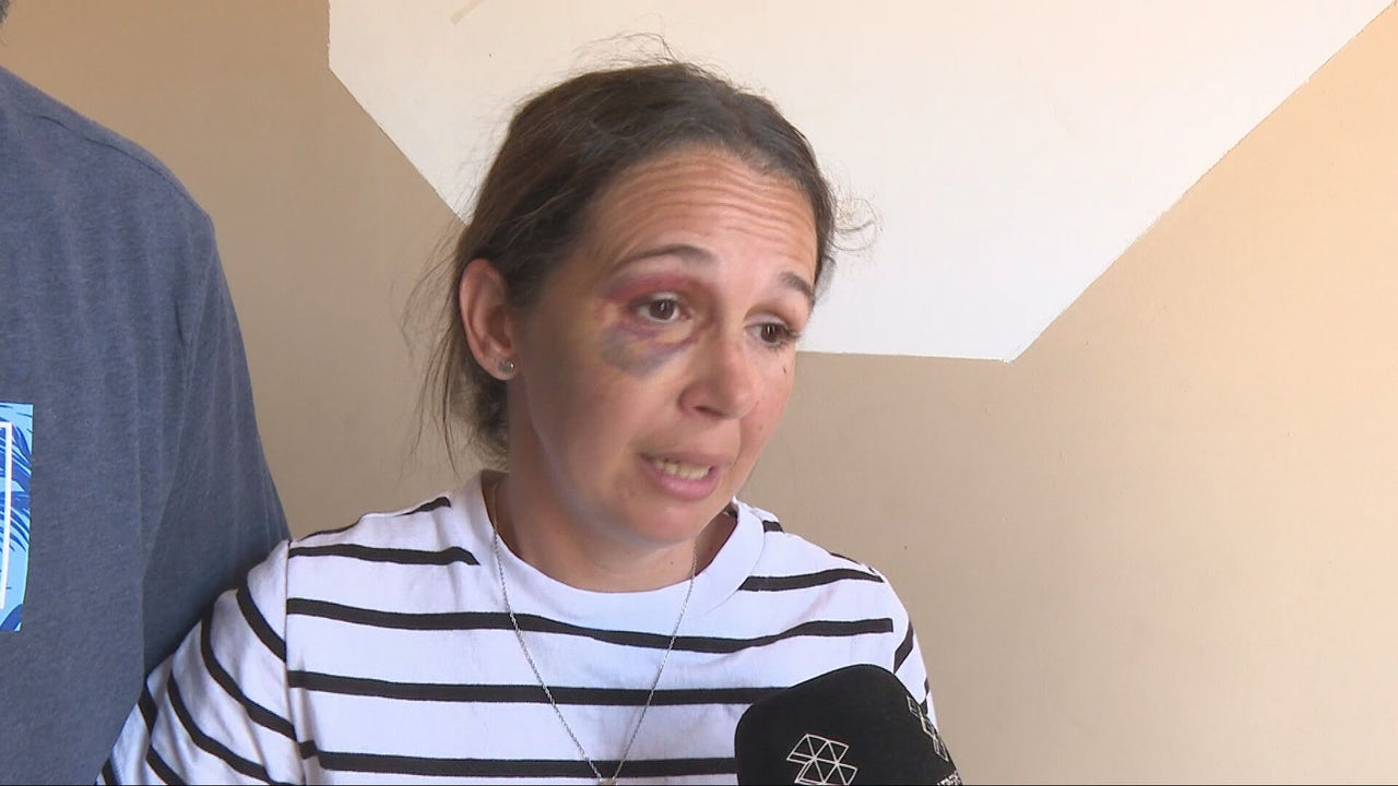 A pregnant woman and her partner tell the brutal beating they received from some squatters